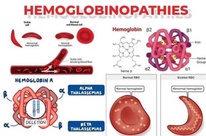 What are the abnormal hemoglobin?
