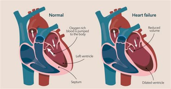 What is the hallmark of heart failure?